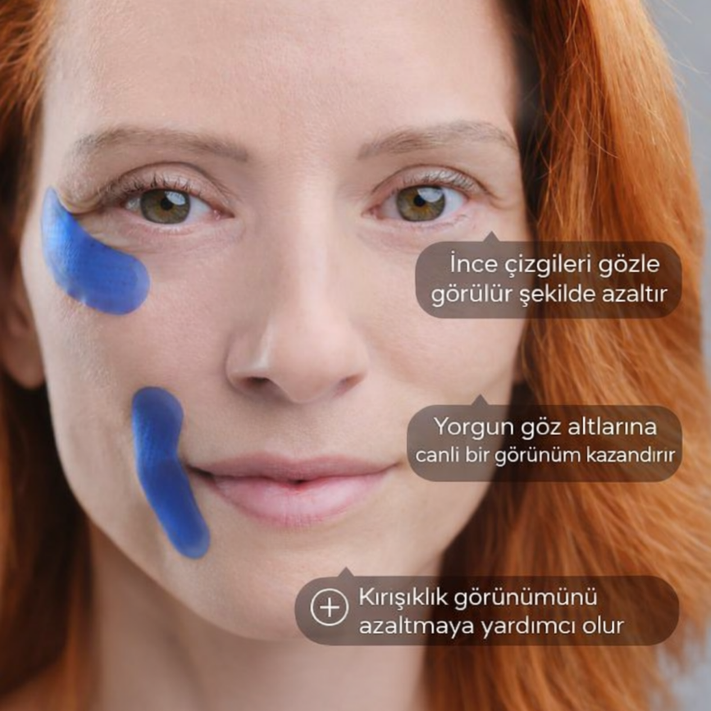 Micro İnfüzyon Dermal Bantlari