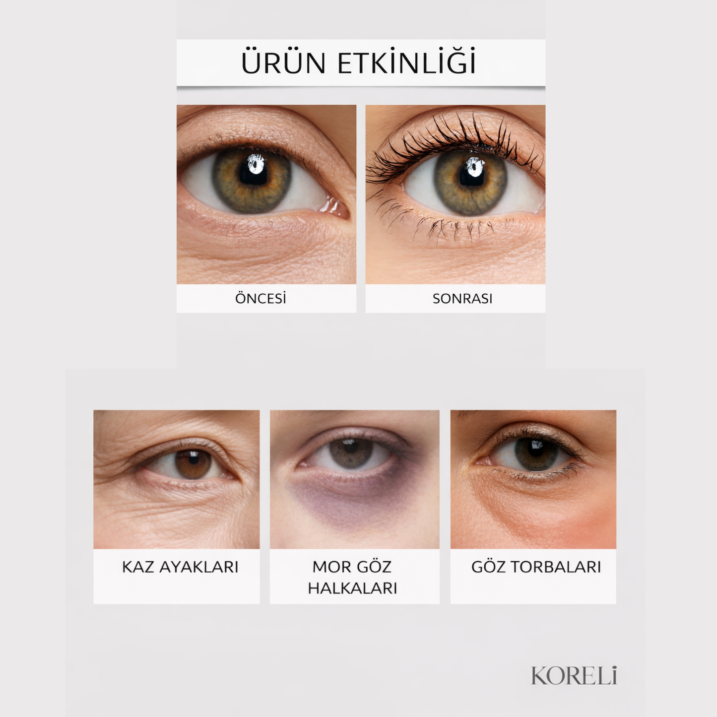 Micro İnfüzyon Dermal Bantlari