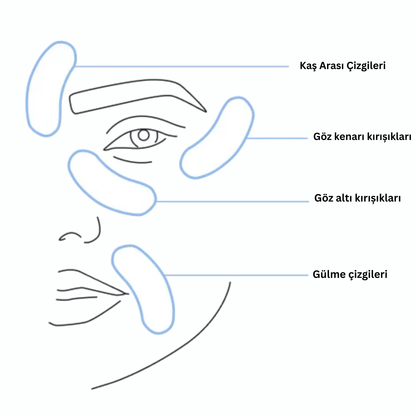 Micro İnfüzyon Dermal Bantlari