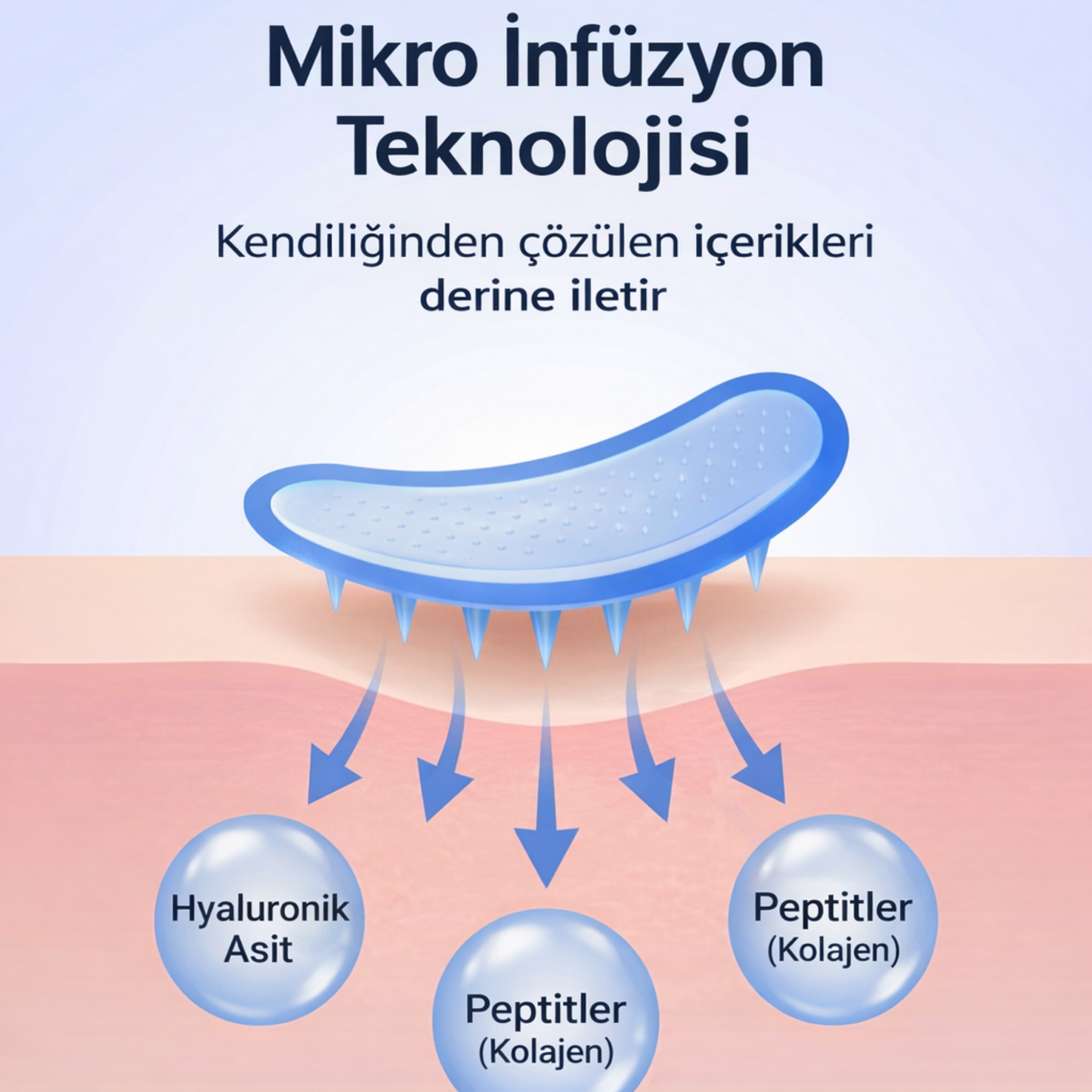 Micro İnfüzyon Dermal Bantlari